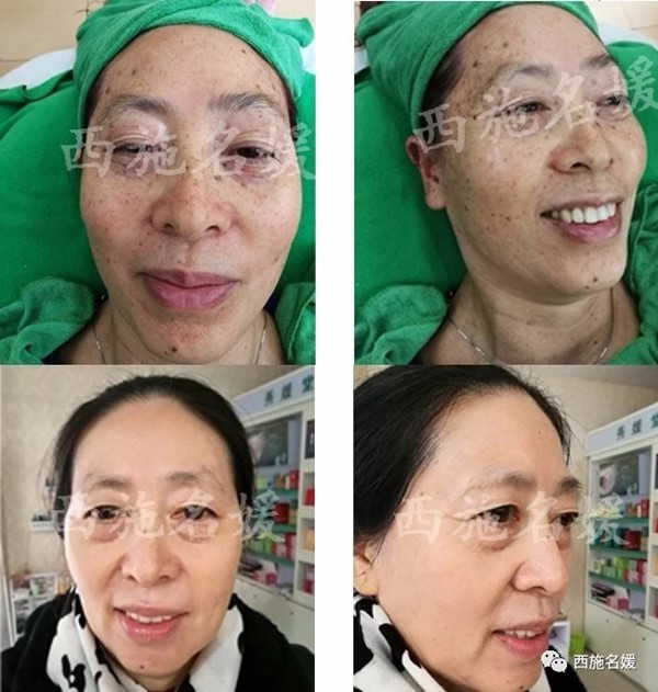 父親節(jié)丨這次換我來守護(hù)爸爸的青春了！