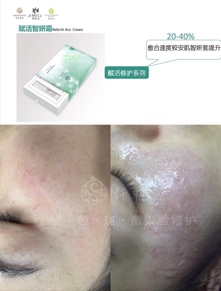 新年新品丨王牌技術(shù)再升級(jí)，祛斑更簡單了。