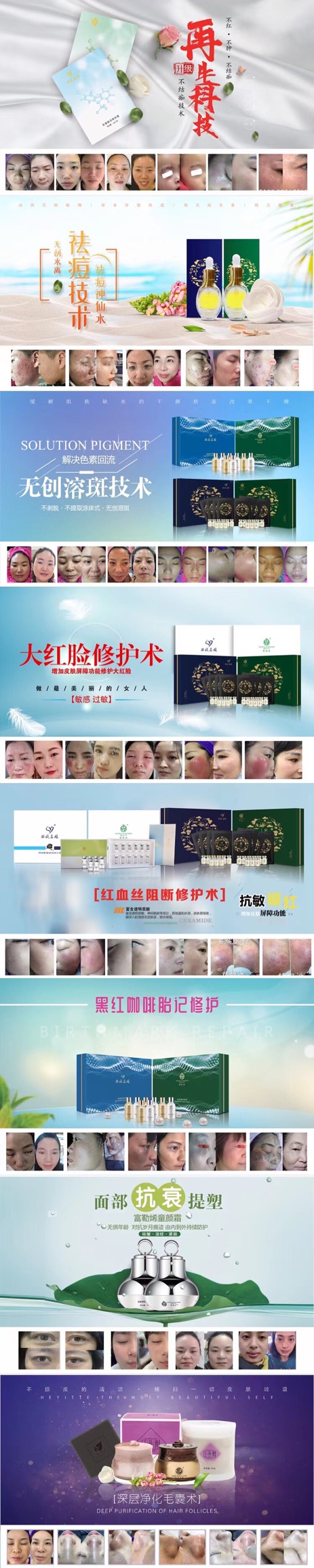 聚勢(shì)成美丨深耕行業(yè)21年，祛斑我們就是標(biāo)準(zhǔn)