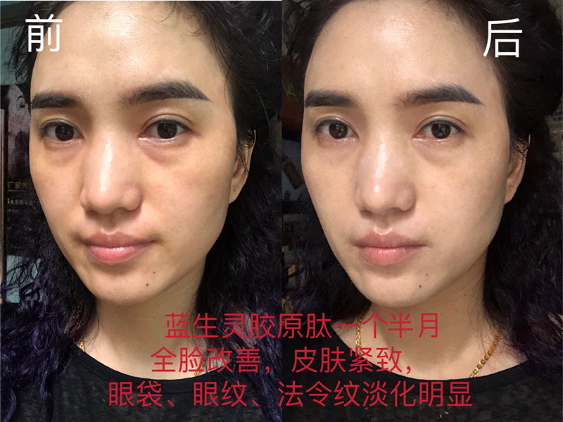 重磅新品丨一月?lián)Q膚！她們是吃了美顏相機(jī)吧？？