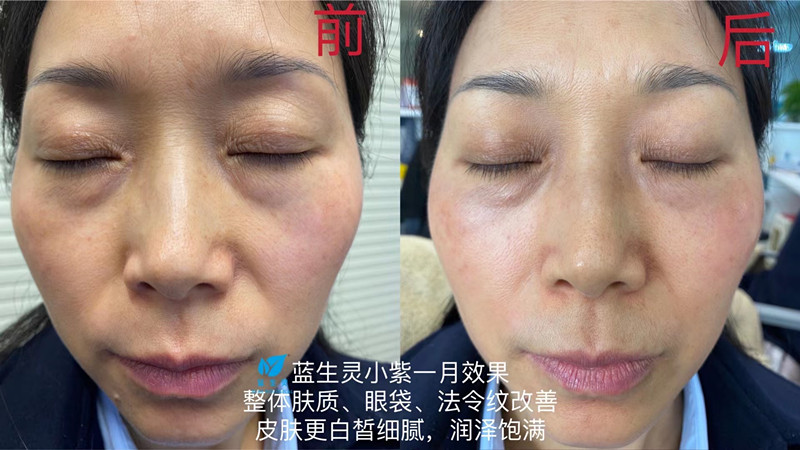 重磅新品丨一月?lián)Q膚！她們是吃了美顏相機(jī)吧？？