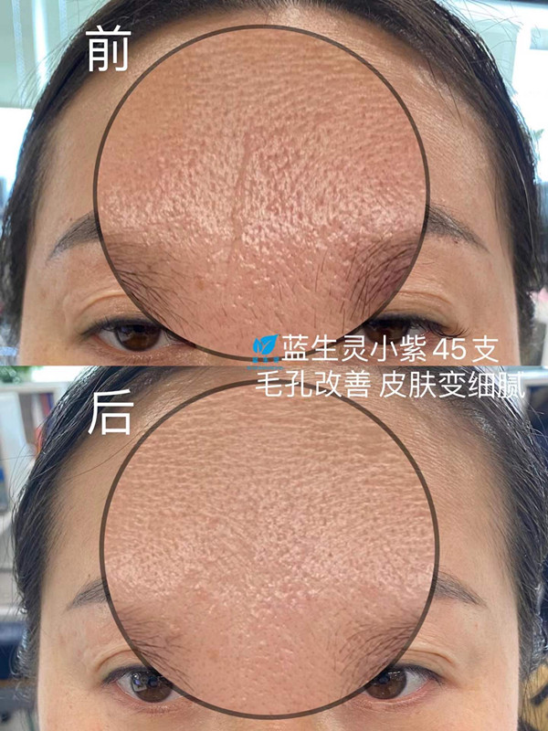 重磅新品丨一月?lián)Q膚！她們是吃了美顏相機(jī)吧？？