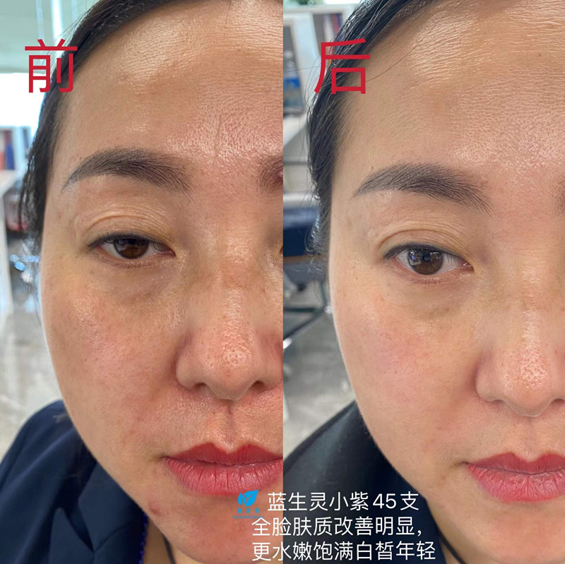 重磅新品丨一月?lián)Q膚！她們是吃了美顏相機(jī)吧？？