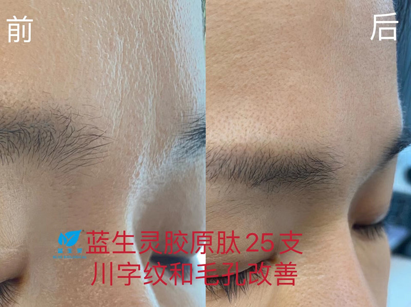 重磅新品丨一月?lián)Q膚！她們是吃了美顏相機(jī)吧？？