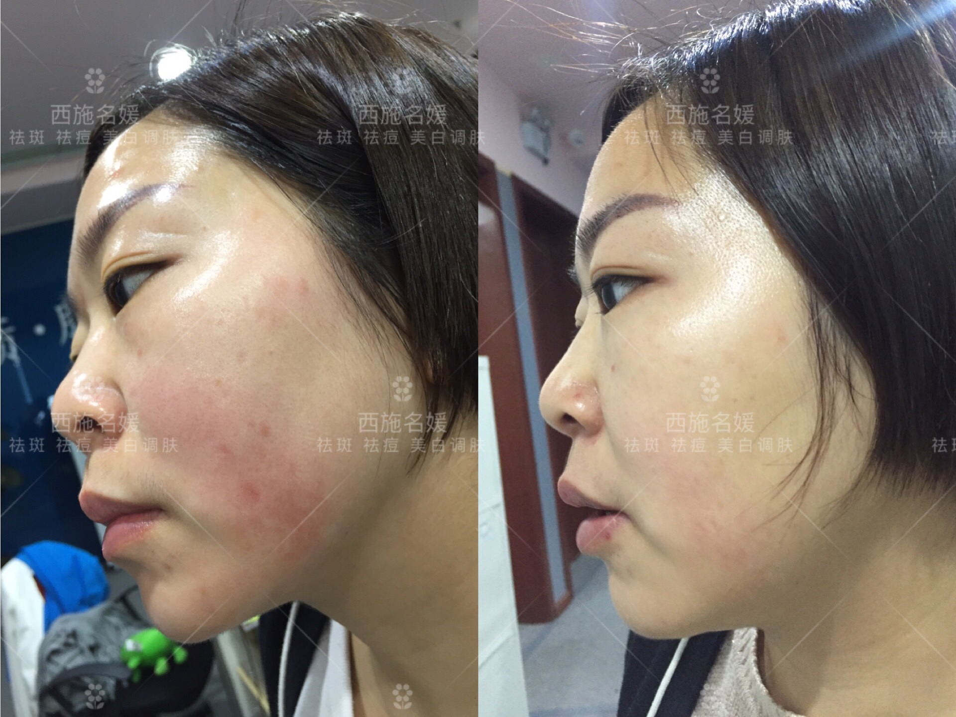 爆品丨西施名媛藍(lán)銅肽安膚套、纖雅源積雪草舒潤(rùn)套