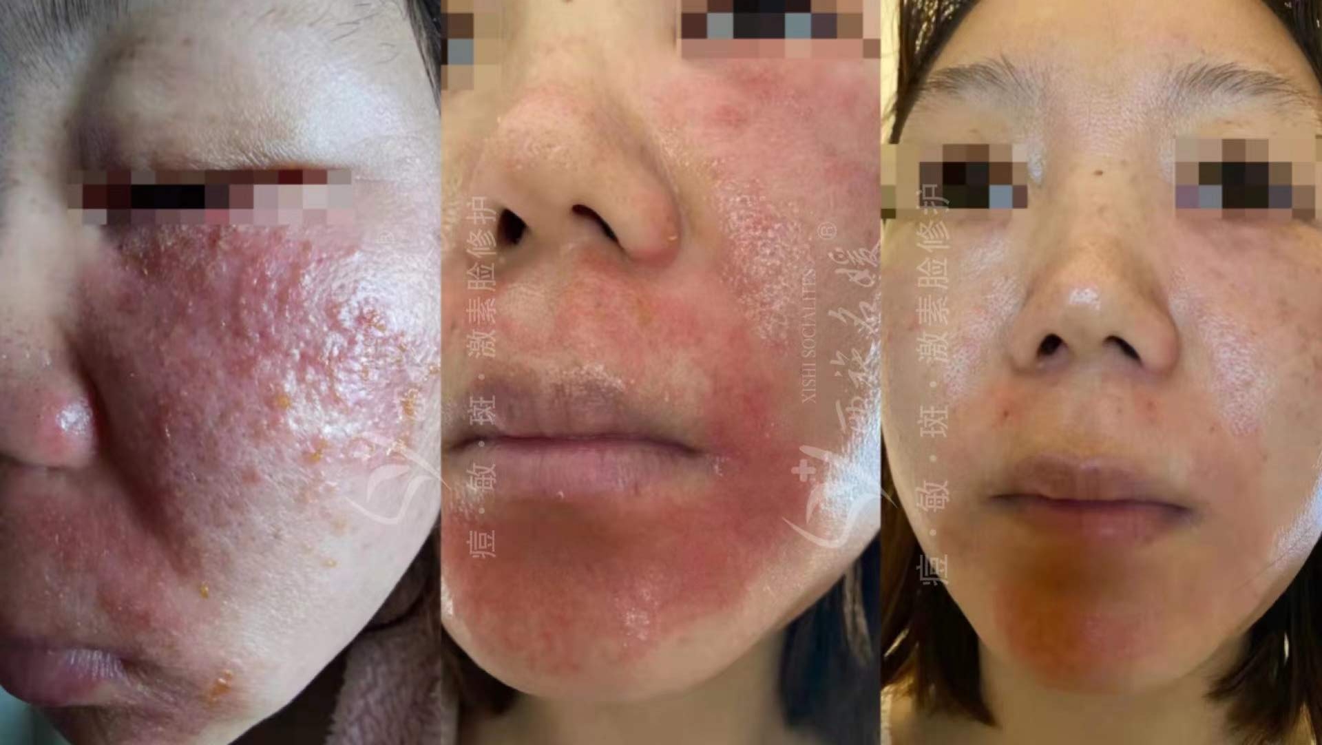 爆品丨西施名媛藍(lán)銅肽安膚套、纖雅源積雪草舒潤(rùn)套