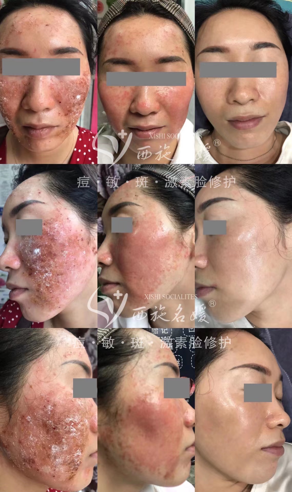爆品丨西施名媛藍(lán)銅肽安膚套、纖雅源積雪草舒潤(rùn)套
