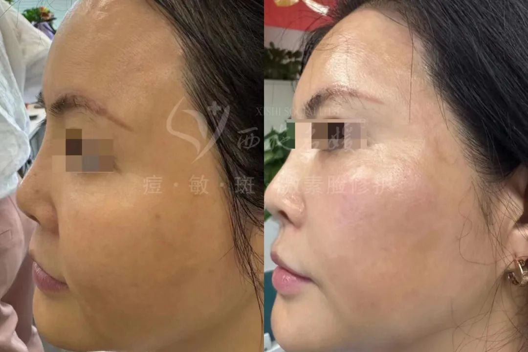 新品速遞丨拓客王者，升級(jí)回歸